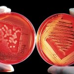Bacterii, CFU, Medicina